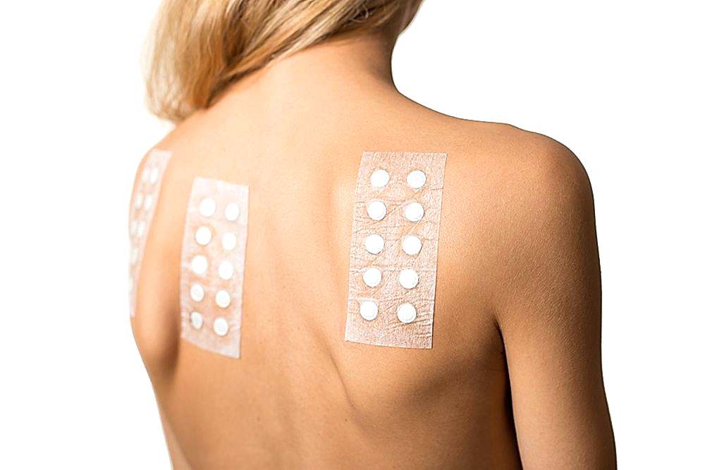 SKIN PATCH TEST