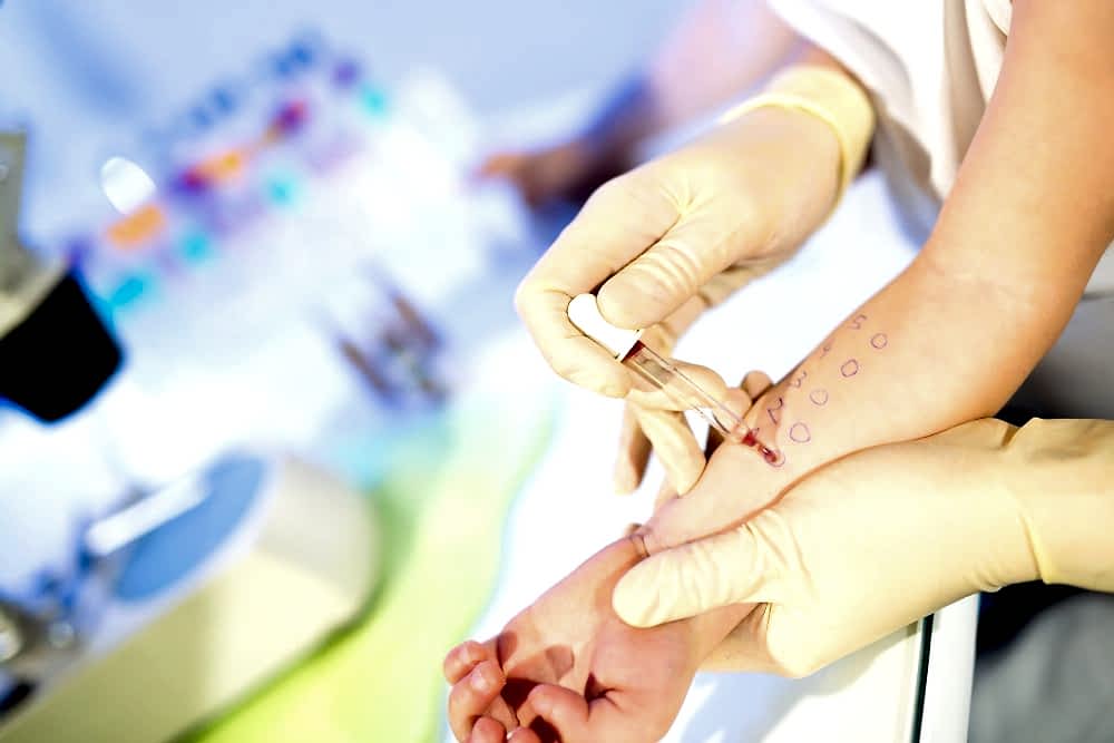 AUTOLOGOUS SERUM TEST