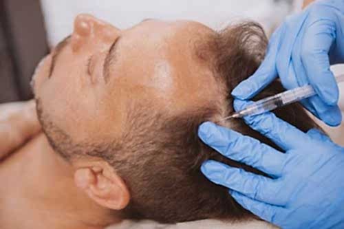 HAIR LOSS