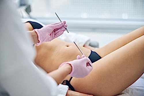 SKIN BIOPSY