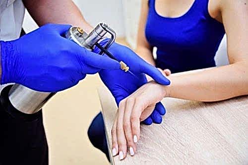CRYOTHERAPY