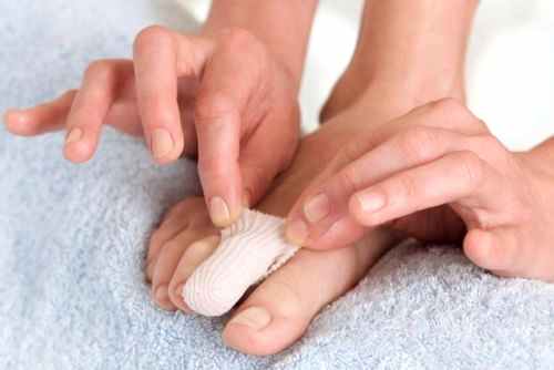 NAIL SURGERY