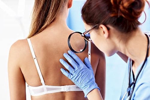 DERMATOLOGICAL EXAMINATION