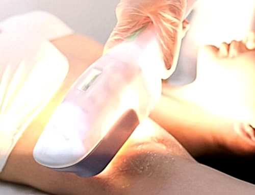 LAZER EPİLASYONDA KULLANILAN IŞIK SİSTEMLERİ